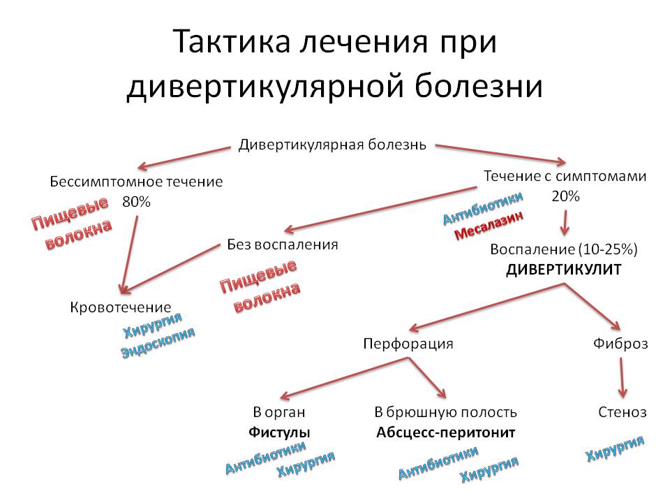 Тактика лечения при дивертикулярной болезни